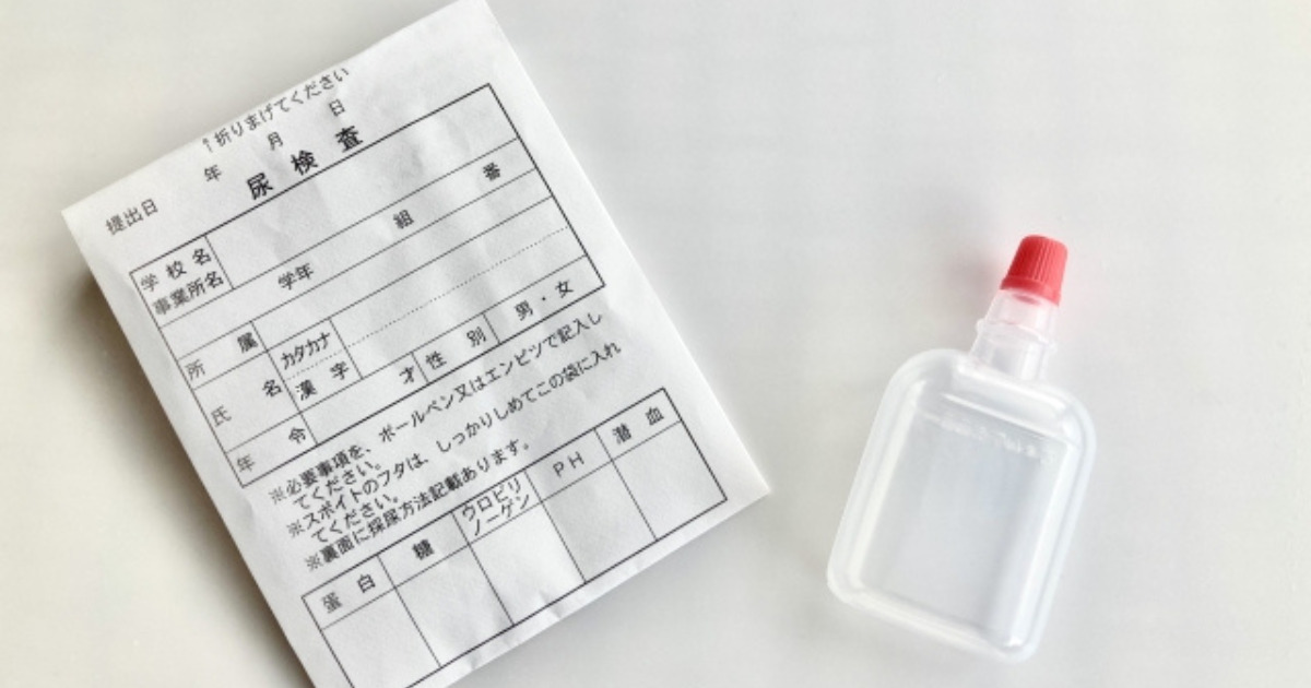 アイキャッチ／ふじメディカル：検査の信頼性。横浜市に認可された自社の衛生検査所の尿検査イメージ画像